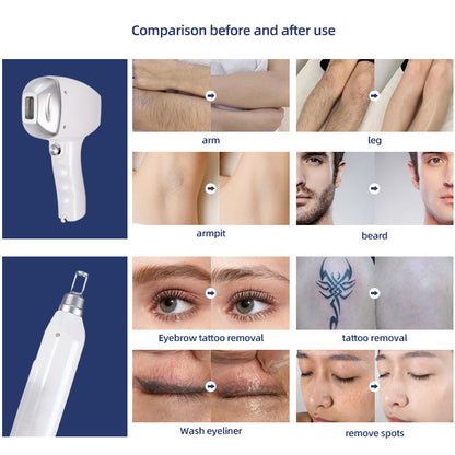 2-in-1 Advanced Laser System(LP-912) – Diode Laser (with 300W TEC Cooling) + Picosecond Laser